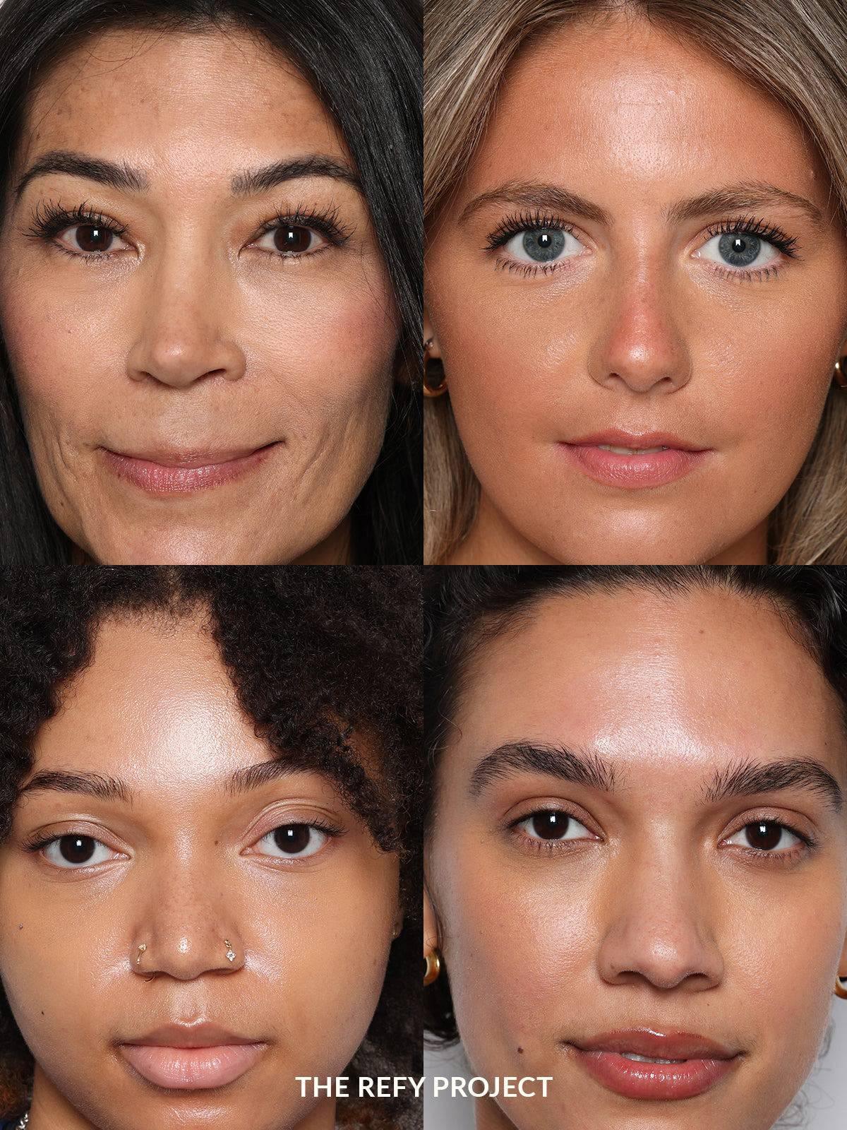 Refy Concealer - Kapatıcı