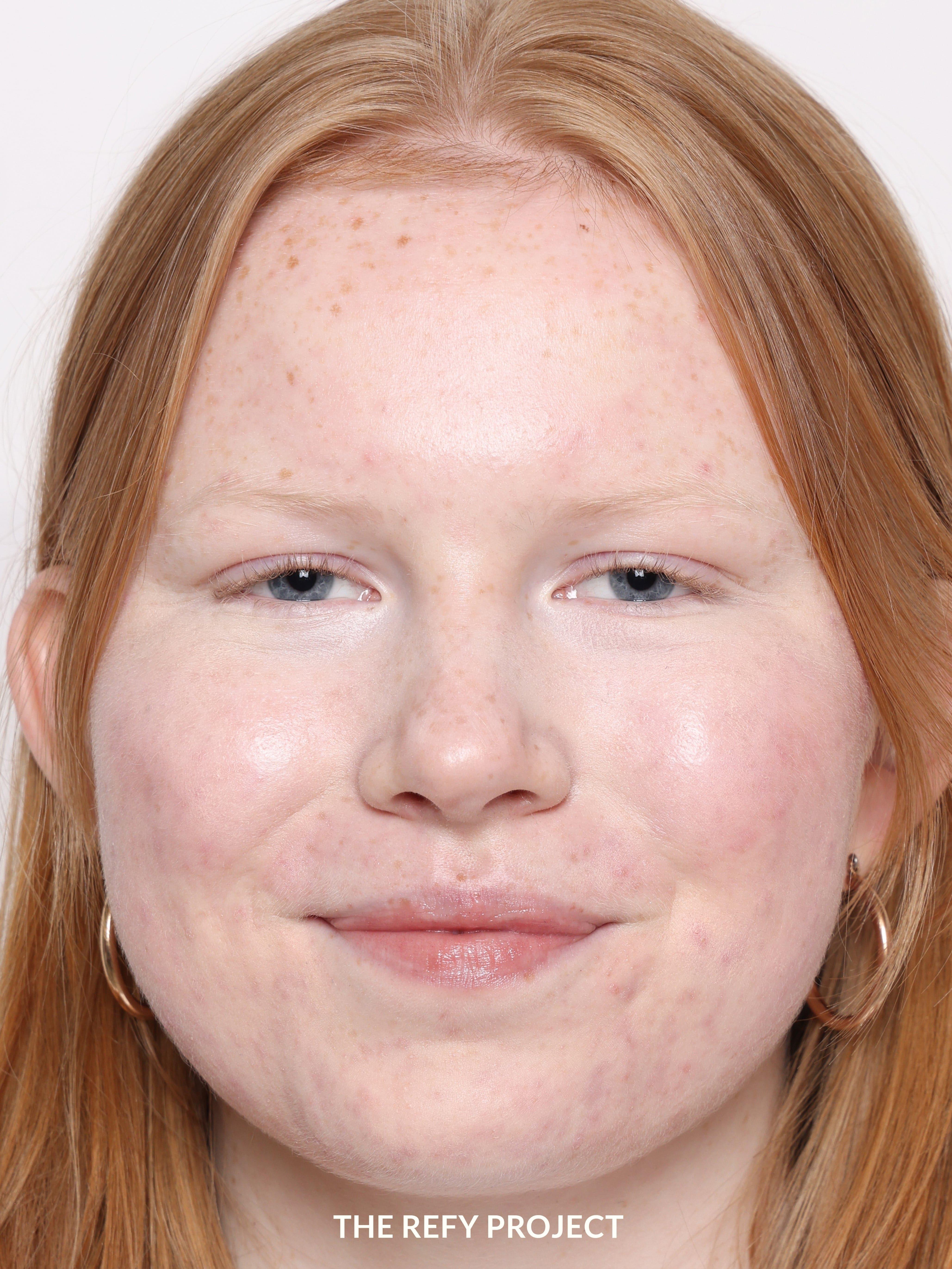 Refy Concealer - Kapatıcı